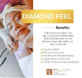 Diamond Peel